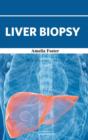 Image for Liver Biopsy