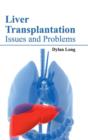 Image for Liver Transplantation: Issues and Problems