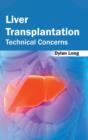 Image for Liver Transplantation: Technical Concerns