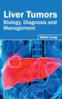 Image for Liver Tumors: Biology, Diagnosis and Management