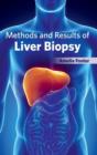 Image for Methods and Results of Liver Biopsy