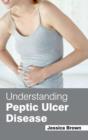 Image for Understanding Peptic Ulcer Disease