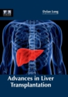 Image for Advances in Liver Transplantation