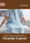 Image for Causes, Stages and Treatment of Ovarian Cancer