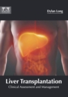 Image for Liver Transplantation: Clinical Assessment and Management