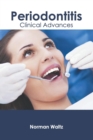 Image for Periodontitis: Clinical Advances