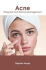 Image for Acne: Diagnosis and Clinical Management