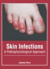Image for Skin Infections: A Pathophysiological Approach