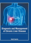 Image for Diagnosis and Management of Chronic Liver Disease