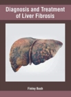Image for Diagnosis and Treatment of Liver Fibrosis