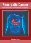 Image for Pancreatic Cancer: Evaluation and Therapeutic Strategies