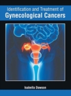 Image for Identification and Treatment of Gynecological Cancers