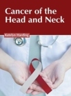 Image for Cancer of the Head and Neck
