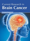 Image for Current Research in Brain Cancer