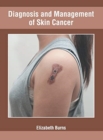 Image for Diagnosis and Management of Skin Cancer
