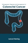 Image for Pathogenesis, Diagnosis and Management of Colorectal Cancer