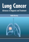 Image for Lung Cancer: Advances in Diagnosis and Treatment