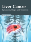 Image for Liver Cancer: Symptoms, Stages and Treatment