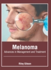 Image for Melanoma: Advances in Management and Treatment