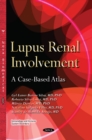 Image for Lupus Renal Involvement