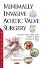 Image for Minimally Invasive Aortic Valve Surgery
