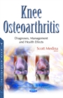 Image for Knee Osteoarthritis