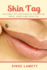 Image for Skin Tag : Natural DIY Methods of removing Mole, Wart and Skin Tag