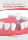 Image for Clinical Advances in Implant Dentistry