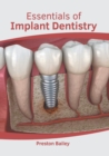 Image for Essentials of Implant Dentistry