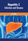 Image for Hepatitis C: Infection and Disease