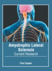 Image for Amyotrophic Lateral Sclerosis: Current Research