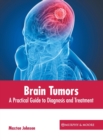 Image for Brain Tumors: A Practical Guide to Diagnosis and Treatment