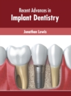 Image for Recent Advances in Implant Dentistry