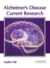 Image for Alzheimer&#39;s Disease: Current Research
