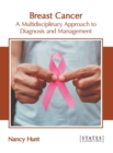 Image for Breast Cancer: A Multidisciplinary Approach to Diagnosis and Management