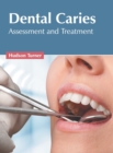 Image for Dental Caries: Assessment and Treatment