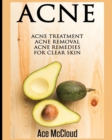 Image for Acne : Acne Treatment: Acne Removal: Acne Remedies For Clear Skin