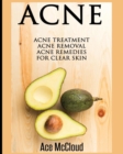 Image for Acne