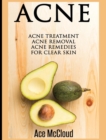 Image for Acne : Acne Treatment: Acne Removal: Acne Remedies For Clear Skin