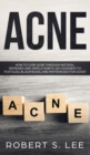 Image for Acne