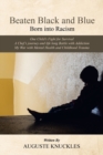 Image for Beaten black and blue  : born into racism