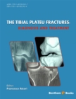 Image for Tibial Plateau Fractures: Diagnosis and Treatment