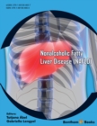 Image for Nonalcoholic Fatty Liver Disease (NAFLD)