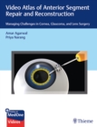 Image for Video Atlas of Anterior Segment Repair and Reconstruction : Managing Challenges in Cornea, Glaucoma, and Lens Surgery
