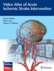Image for Video atlas of acute ischemic stroke intervention