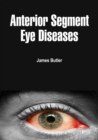 Image for Anterior Segment Eye Diseases
