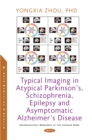 Image for Typical Imaging in Atypical Parkinson&#39;s, Schizophrenia, Epilepsy and Asymptomatic Alzheimer&#39;s Disease