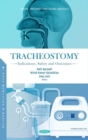 Image for Tracheostomy  : indications, safety and outcomes