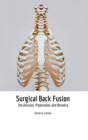 Image for Surgical Back Fusion