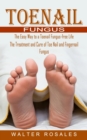 Image for Toenail Fungus : The Easy Way to a Toenail Fungus-free Life (The Treatment and Cure of Toe Nail and Fingernail Fungus)